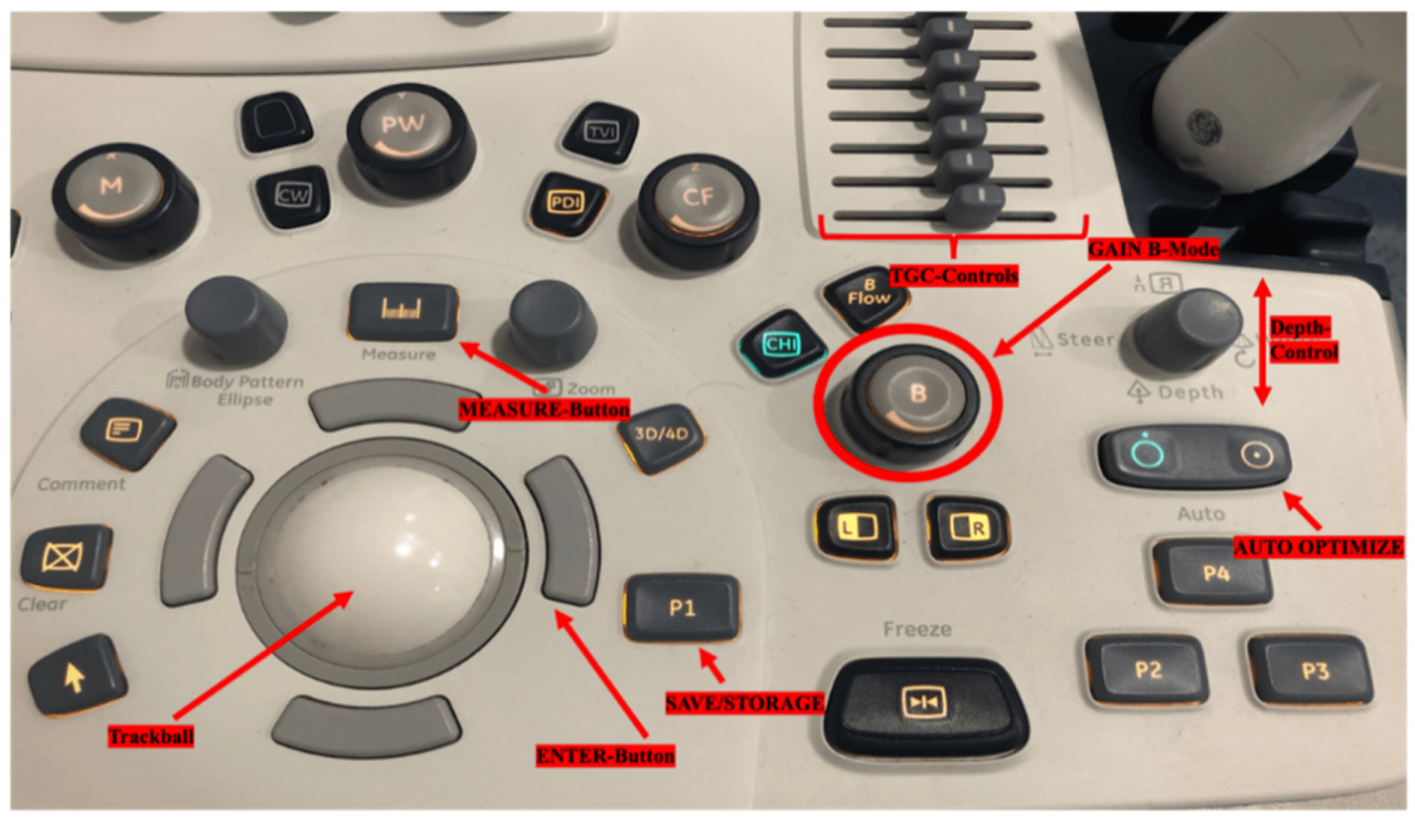 Knobology ultrasound machine buttons and functions